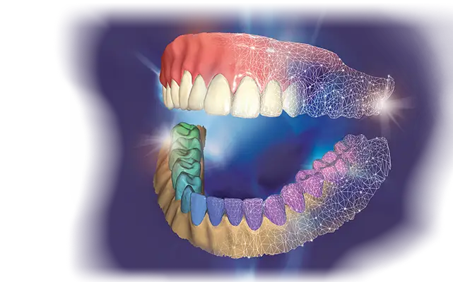 برنامج إكسوكاد (Exocad)